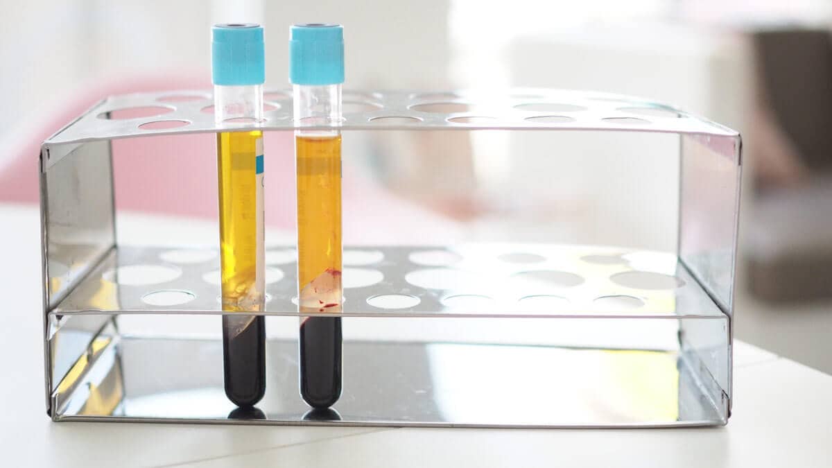 PRP-Behandlung