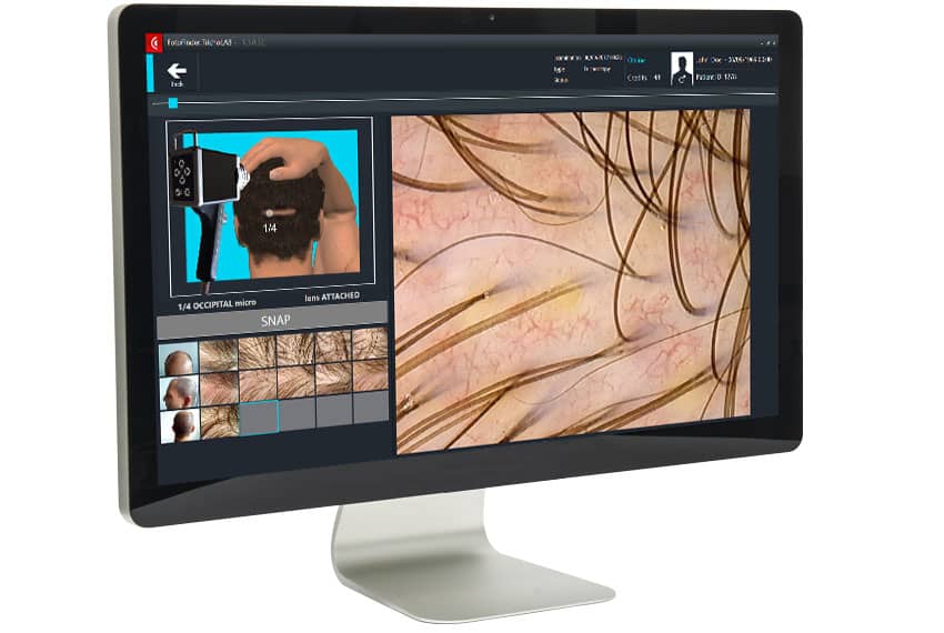 FotoFinder